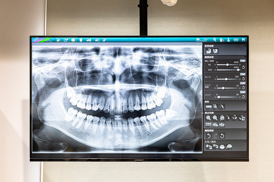 説明用モニター